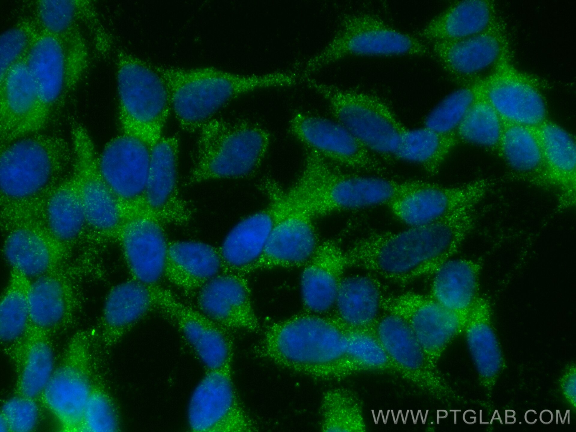 Immunofluorescence (IF) / fluorescent staining of SH-SY5Y cells using Adropin Polyclonal antibody (25213-1-AP)