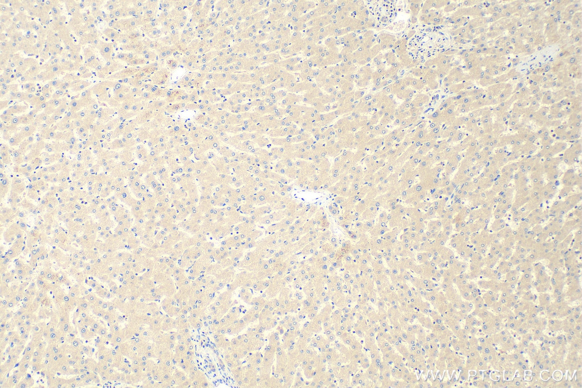 Immunohistochemistry (IHC) staining of human liver tissue using Adropin Polyclonal antibody (25213-1-AP)