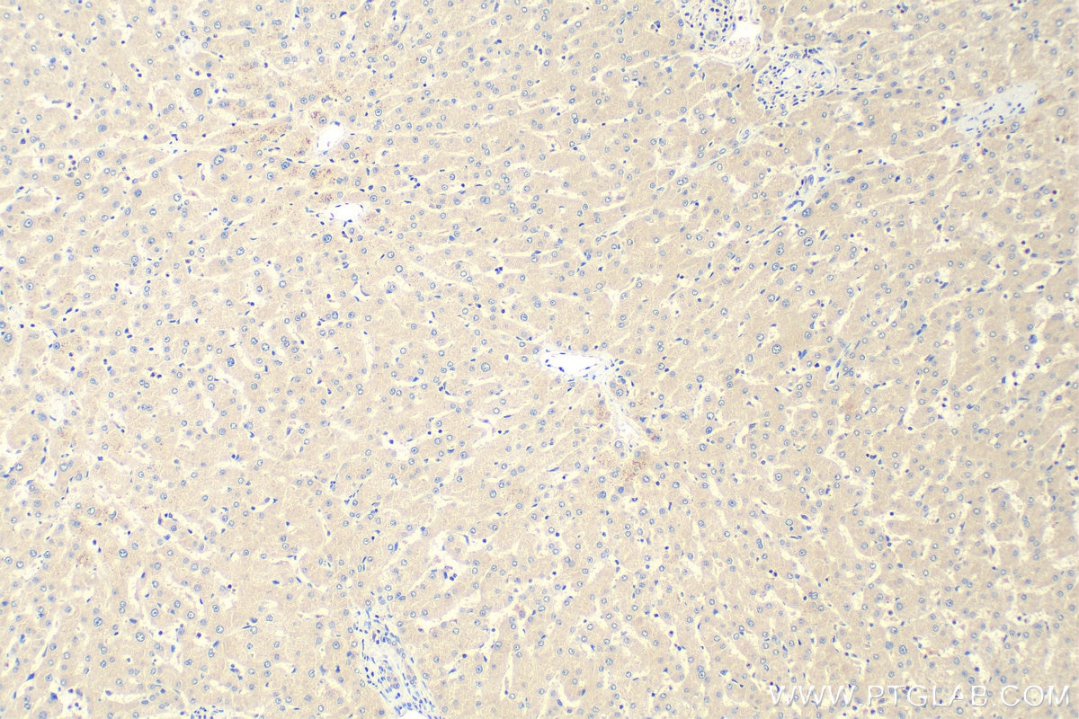 Immunohistochemistry (IHC) staining of human liver tissue using Adropin Polyclonal antibody (25213-1-AP)