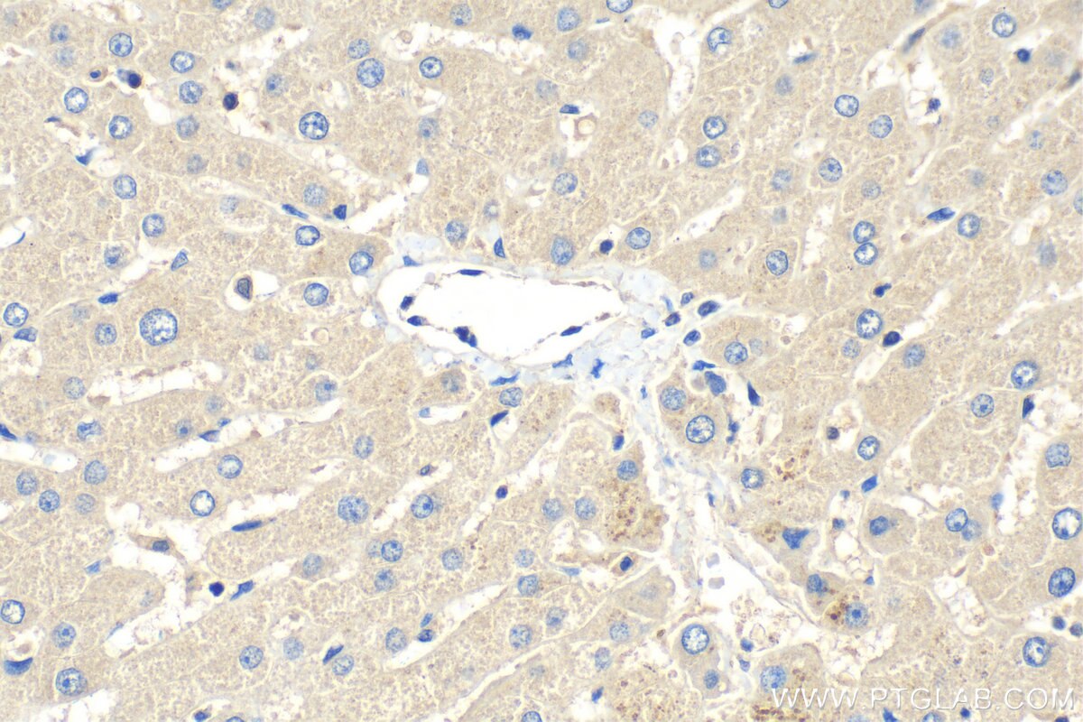 Immunohistochemistry (IHC) staining of human liver tissue using Adropin Polyclonal antibody (25213-1-AP)