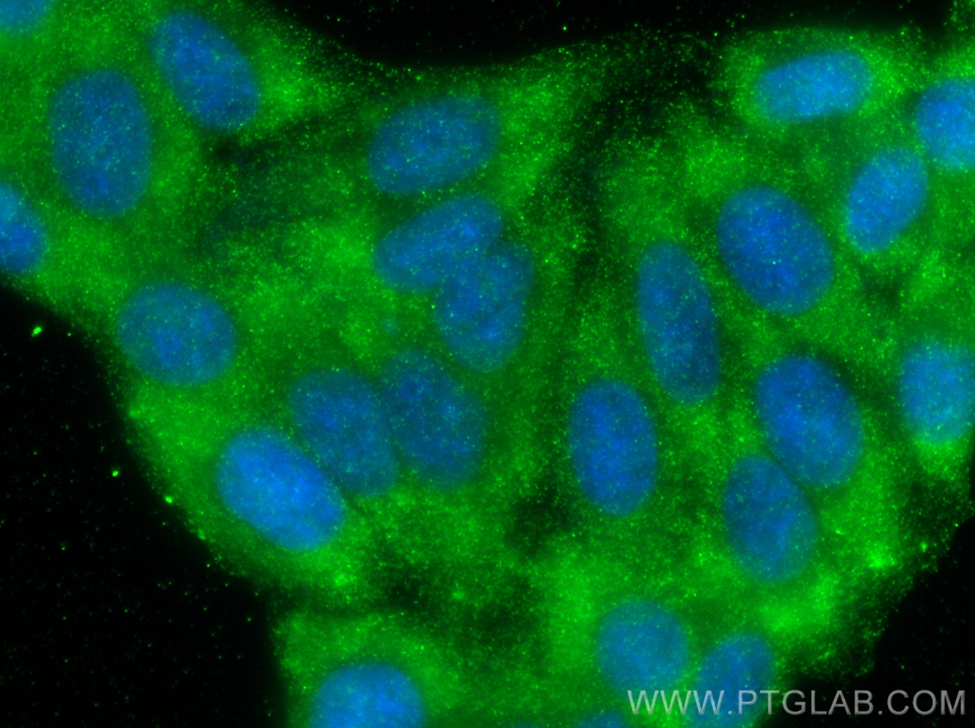 Immunofluorescence (IF) / fluorescent staining of HepG2 cells using Afp Polyclonal antibody (31256-1-AP)