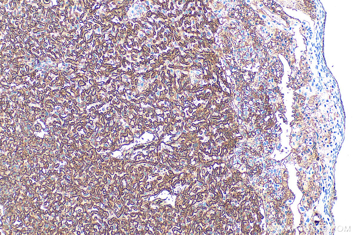 Immunohistochemistry (IHC) staining of mouse placenta tissue using AFP Polyclonal antibody (31256-1-AP)