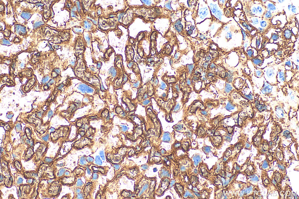 Immunohistochemistry (IHC) staining of mouse placenta tissue using AFP Polyclonal antibody (31256-1-AP)