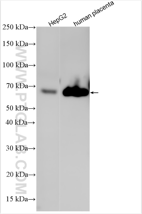 Western Blot (WB) analysis of various lysates using Afp Polyclonal antibody (31256-1-AP)