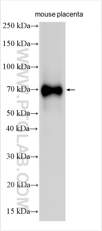 Western Blot (WB) analysis of various lysates using Afp Polyclonal antibody (31256-1-AP)