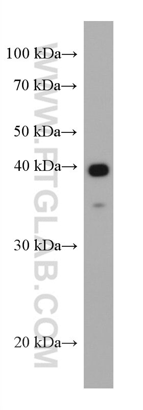 WB analysis of Recombinant protein using 67743-1-Ig