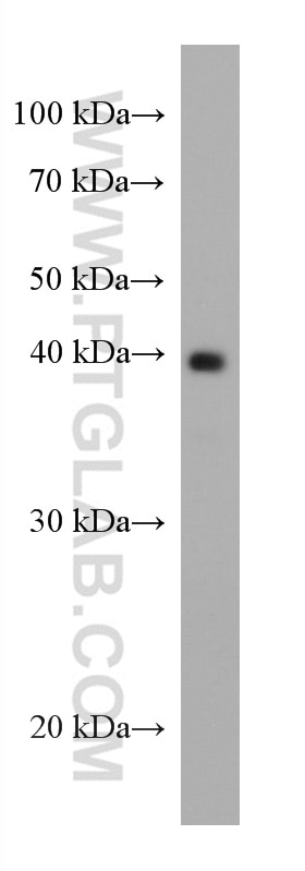 Western Blot (WB) analysis of Recombinant protein using AgBR1 Monoclonal antibody (67743-1-Ig)