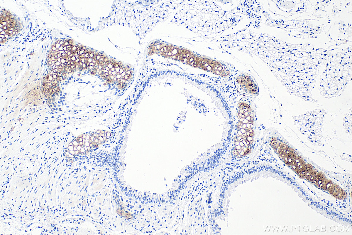 Immunohistochemistry (IHC) staining of mouse lung tissue using Aggrecan Recombinant monoclonal antibody (84819-5-RR)