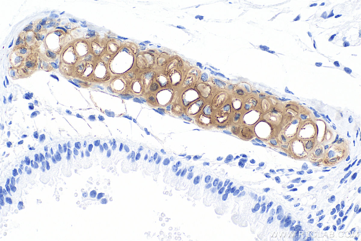 Immunohistochemistry (IHC) staining of mouse lung tissue using Aggrecan Recombinant monoclonal antibody (84819-5-RR)
