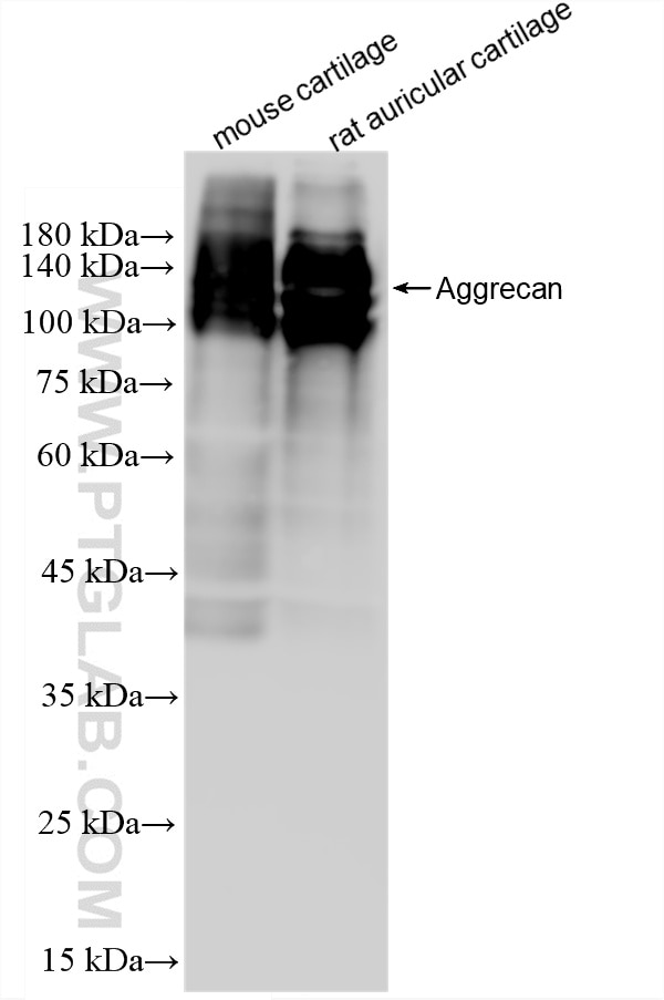 Western Blot (WB) analysis of various lysates using Aggrecan Recombinant monoclonal antibody (84819-5-RR)