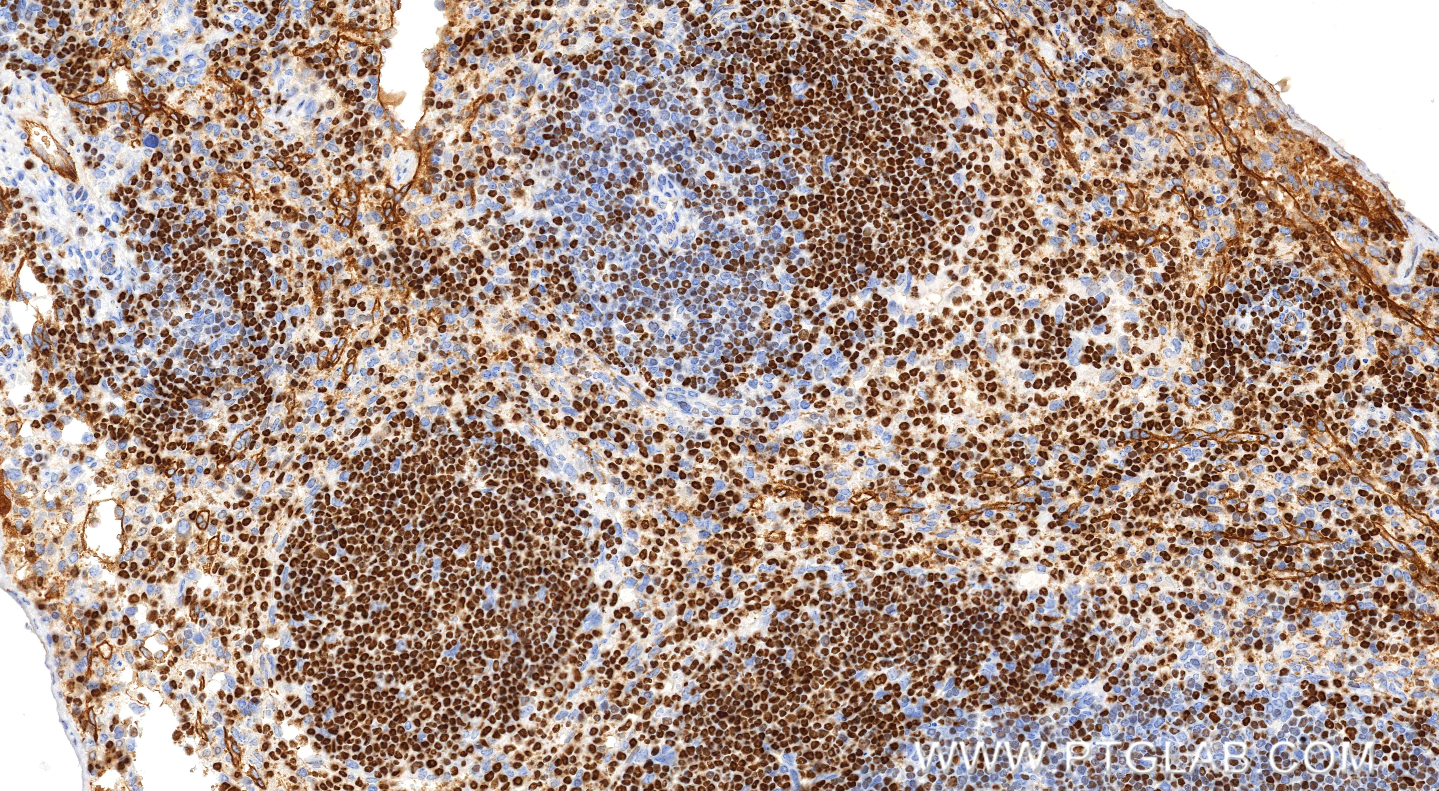 Immunohistochemistry (IHC) staining of mouse spleen tissue using Aiolos/IKZF3 Recombinant monoclonal antibody (85752-2-RR)