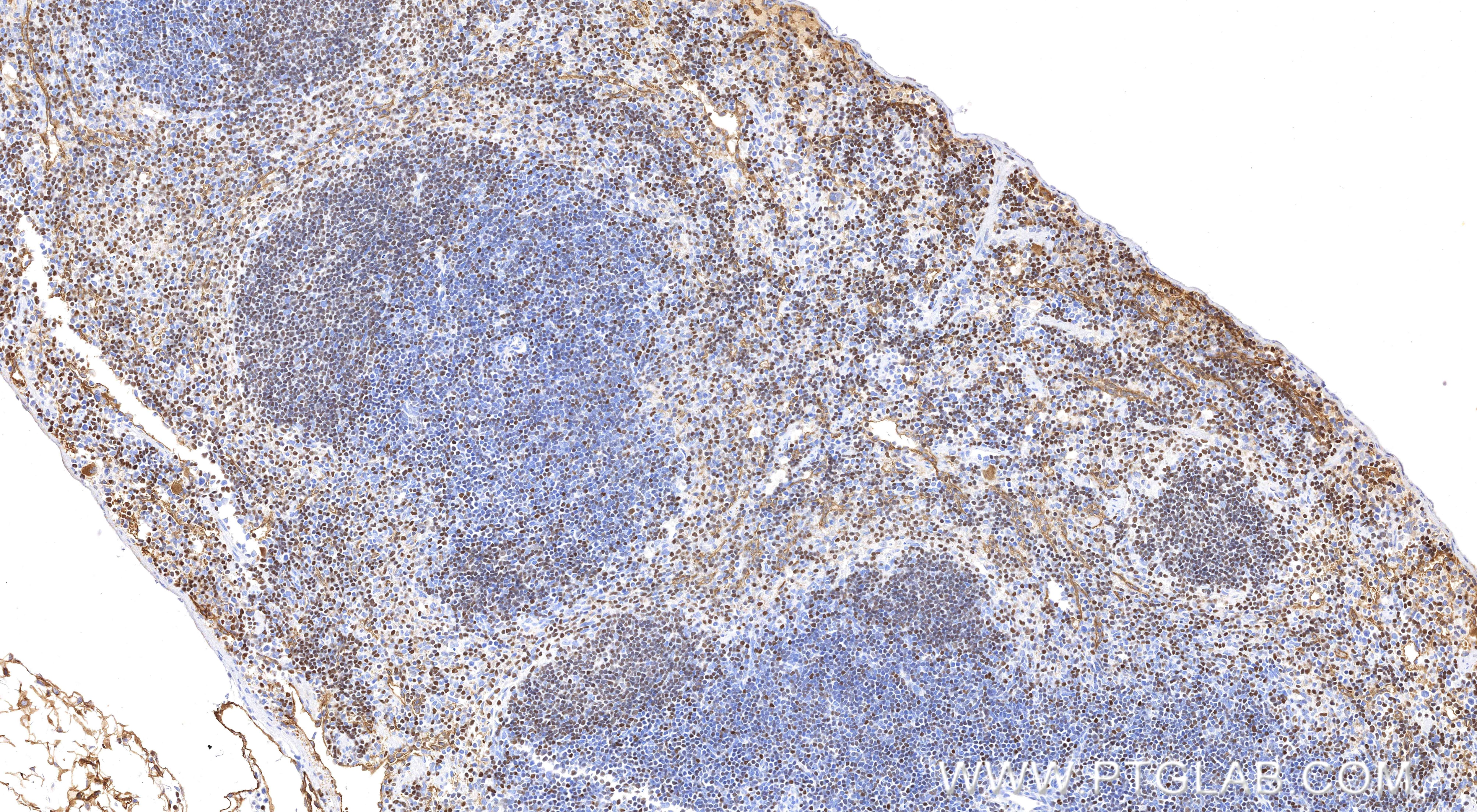 Immunohistochemistry (IHC) staining of mouse spleen tissue using Aiolos/IKZF3 Recombinant monoclonal antibody (85752-2-RR)