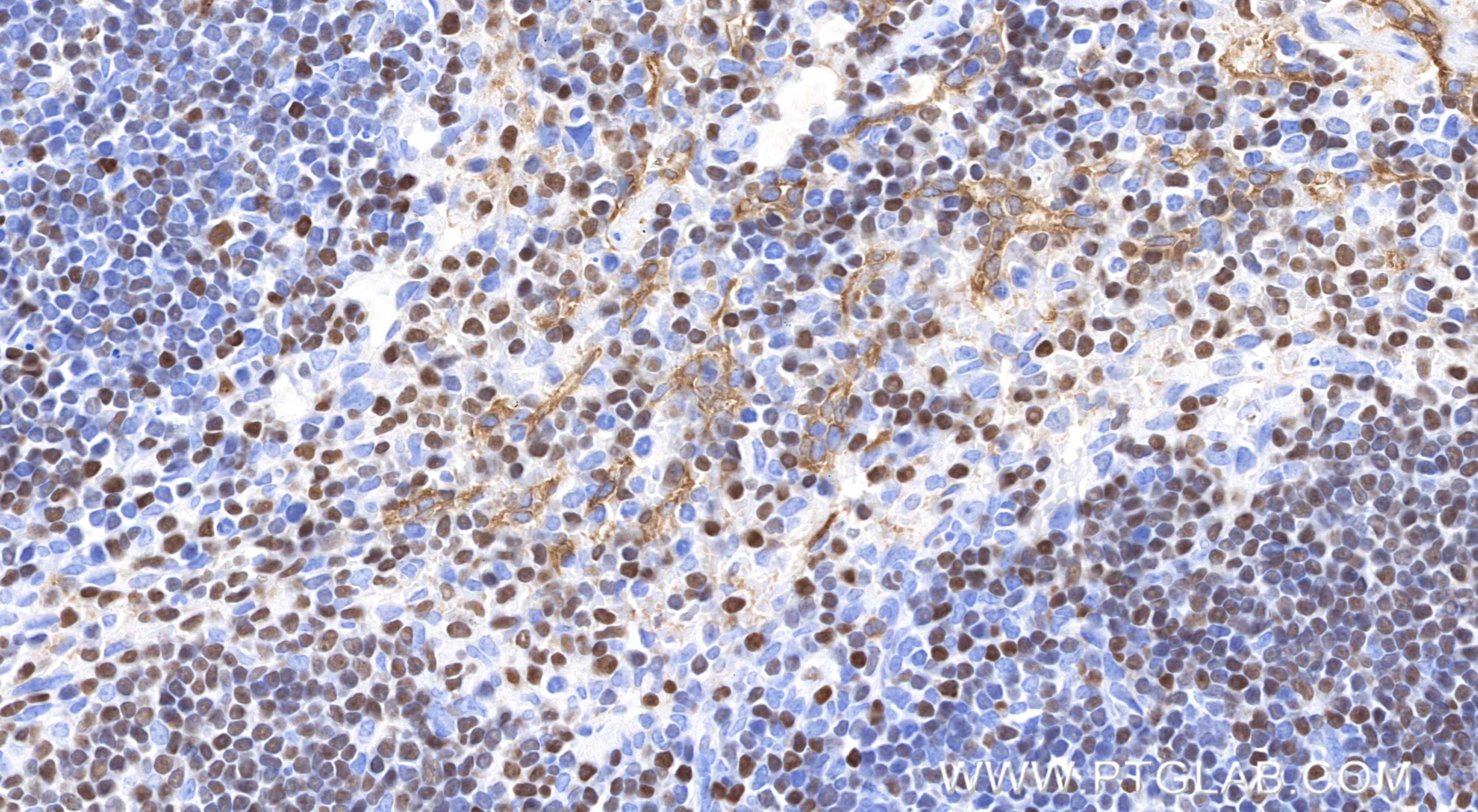 Immunohistochemistry (IHC) staining of mouse spleen tissue using Aiolos/IKZF3 Recombinant monoclonal antibody (85752-2-RR)