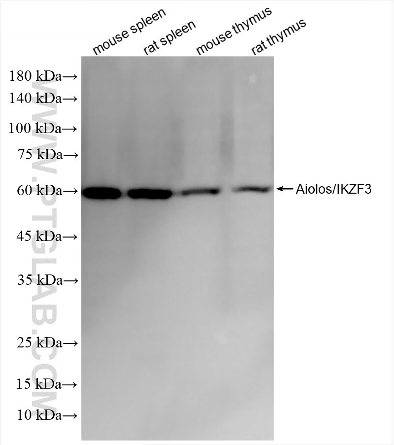 Aiolos/IKZF3