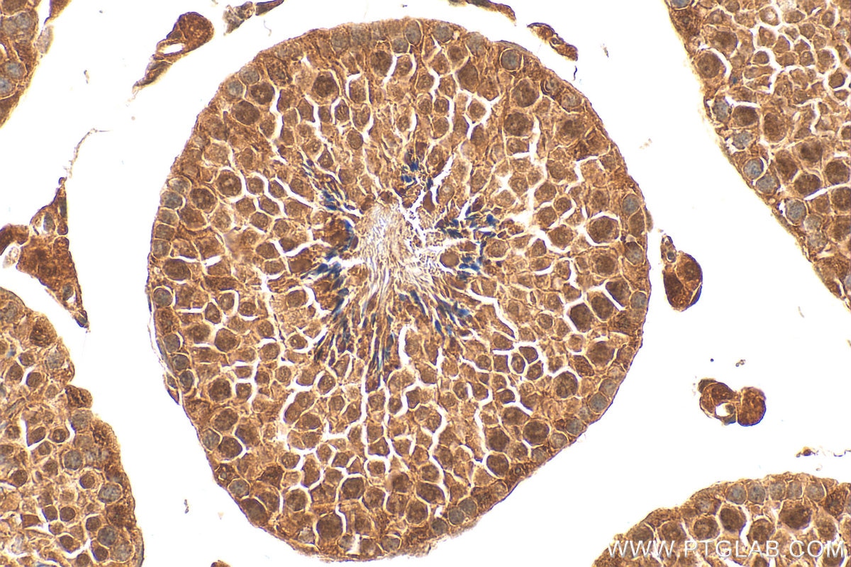IHC staining of mouse testis using 28686-1-AP Immunohistochemistry (IHC) staining of mouse testis tissue using Ajuba Polyclonal antibody (28686-1-AP)