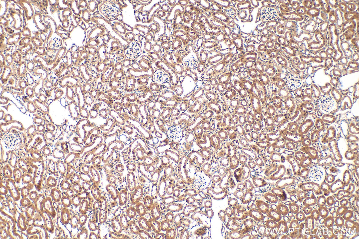 IHC staining of mouse kidney using 28686-1-AP Immunohistochemistry (IHC) staining of mouse kidney tissue using Ajuba Polyclonal antibody (28686-1-AP)