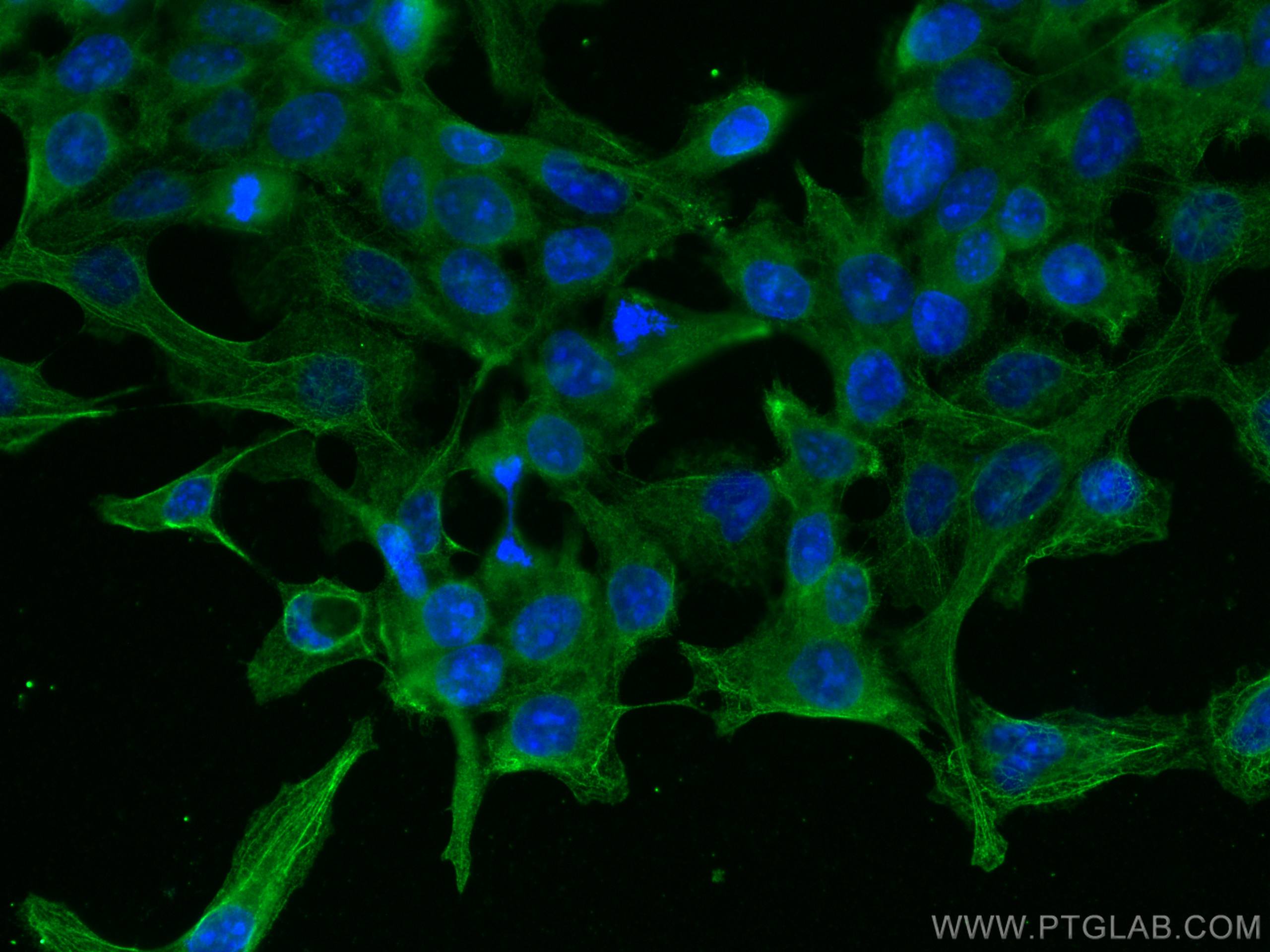 Immunofluorescence (IF) / fluorescent staining of A431 cells using AlaRS Monoclonal antibody (67909-1-Ig)