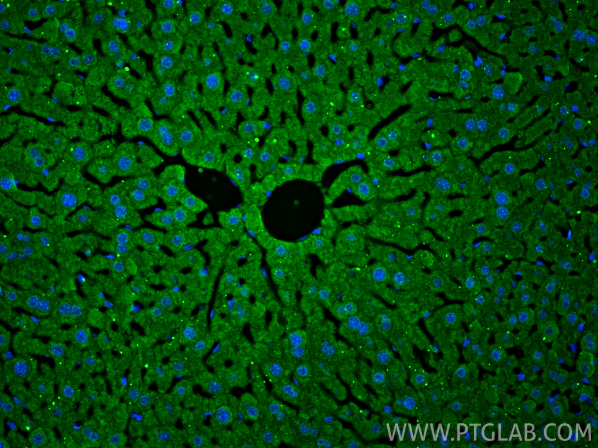 Immunofluorescence (IF) / fluorescent staining of mouse liver tissue using AlaRS Monoclonal antibody (67909-1-Ig)