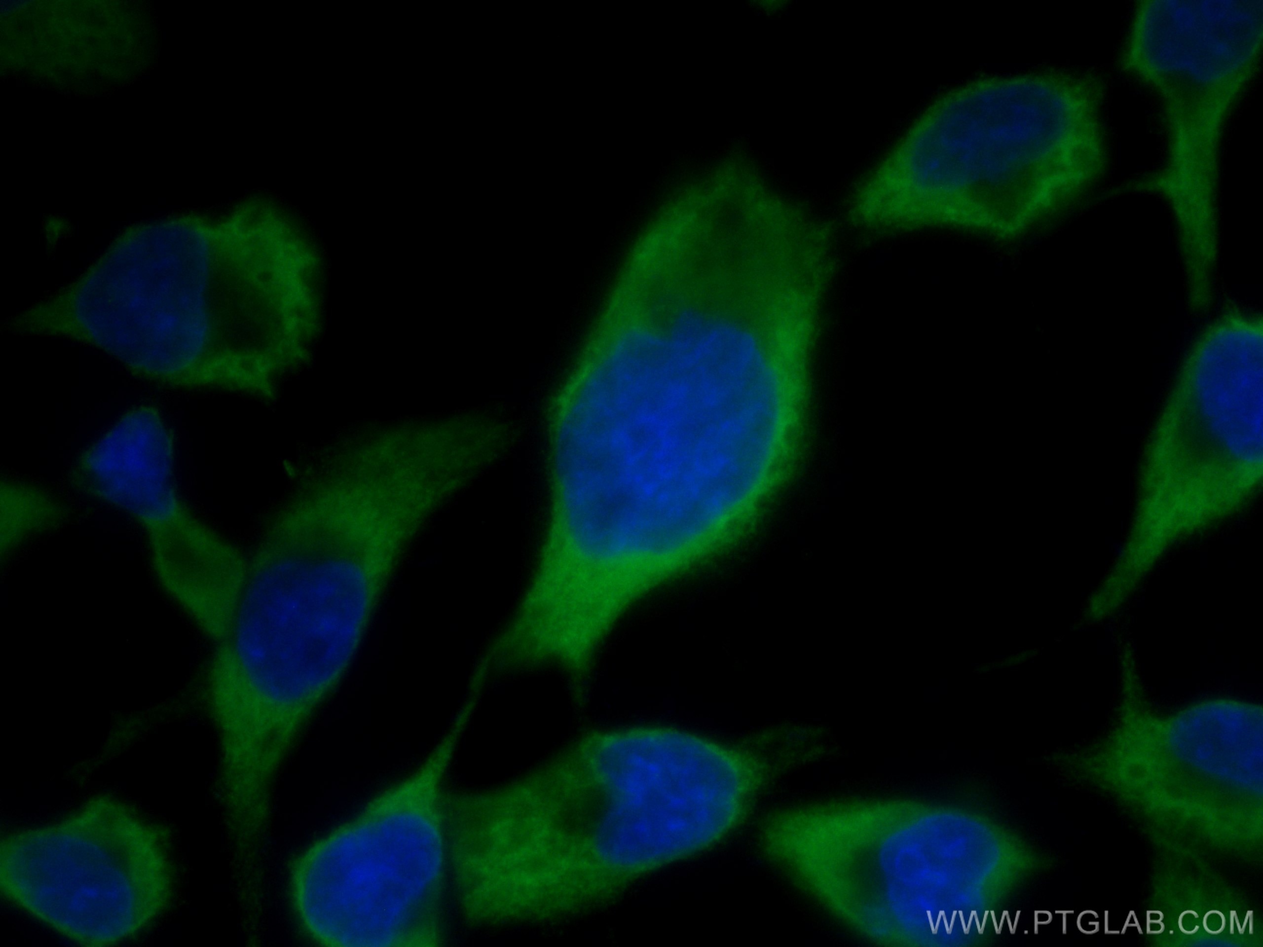 Immunofluorescence (IF) / fluorescent staining of A431 cells using CoraLite® Plus 488-conjugated AlaRS Monoclonal ant (CL488-67909)