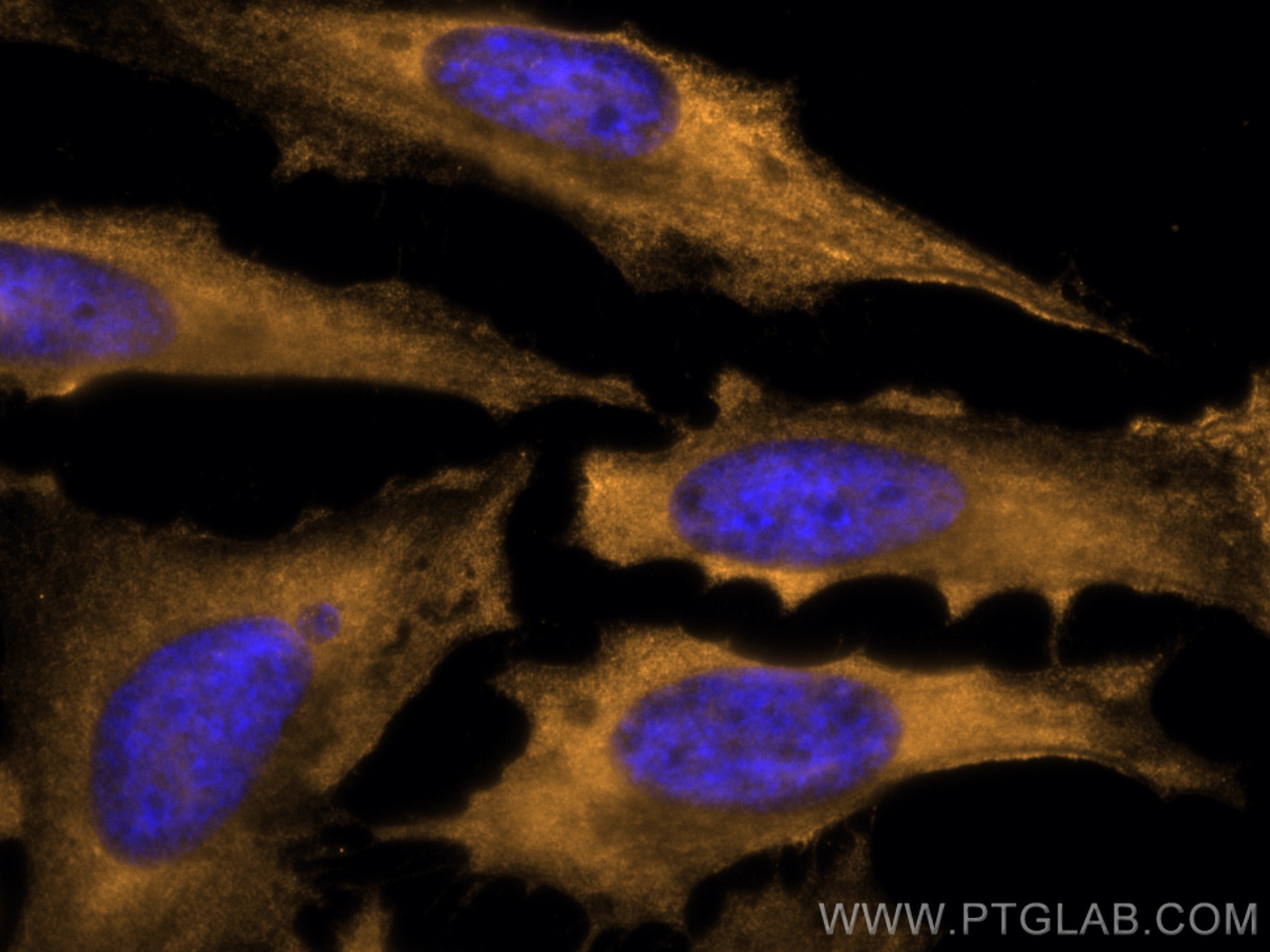 Immunofluorescence (IF) / fluorescent staining of HeLa cells using CoraLite®555-conjugated AlaRS Monoclonal antibody (CL555-67909)