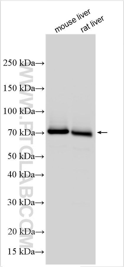 Western Blot (WB) analysis of various lysates using Albumin Polyclonal antibody (31121-1-AP)