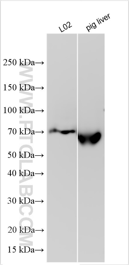 Western Blot (WB) analysis of various lysates using Albumin Polyclonal antibody (31121-1-AP)