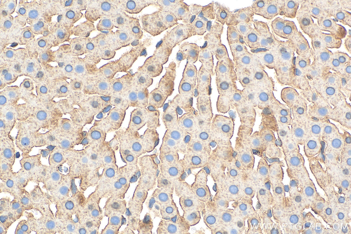 Immunohistochemistry (IHC) staining of rat liver tissue using Albumin Polyclonal antibody (31340-1-AP)