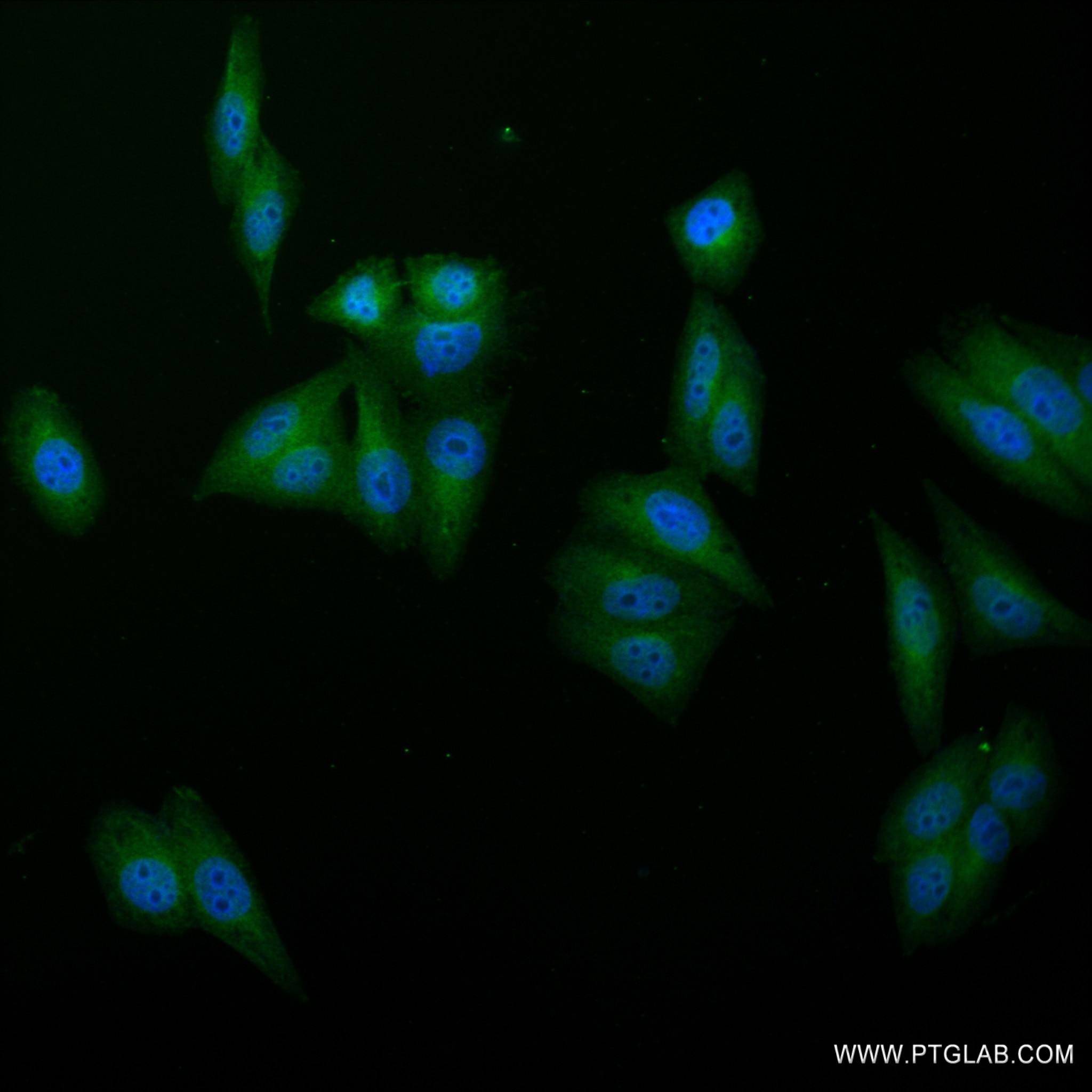 Immunofluorescence (IF) / fluorescent staining of HepG2 cells using Albumin Recombinant antibody (82783-6-RR)