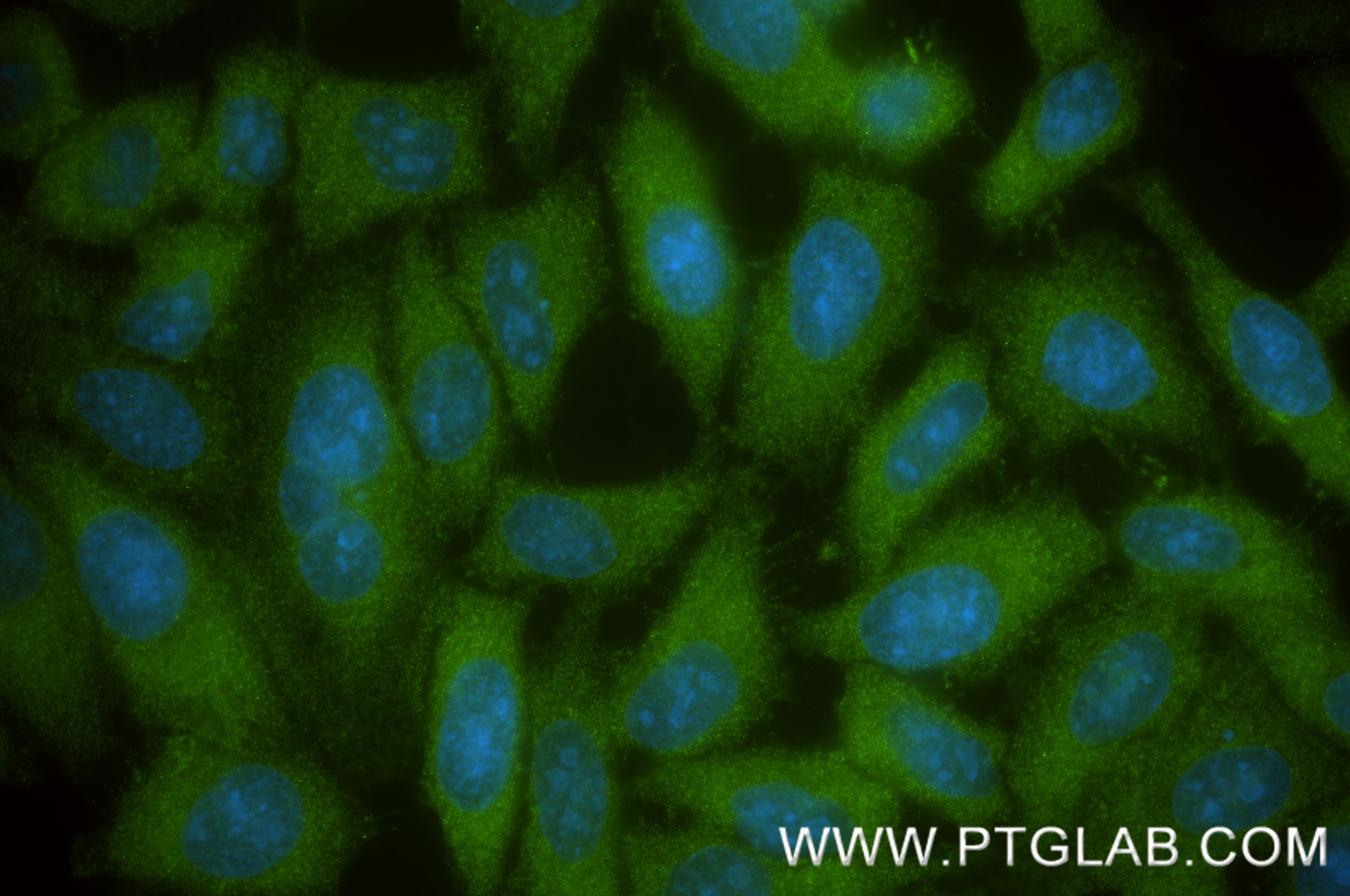IF Staining of HepG2 using 82783-6-RR Immunofluorescence (IF) / fluorescent staining of HepG2 cells using Albumin Recombinant monoclonal antibody (82783-6-RR)