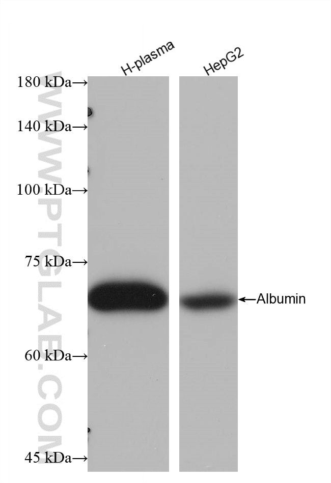 Western Blot (WB) analysis of various lysates using Albumin Recombinant antibody (82783-6-RR)
