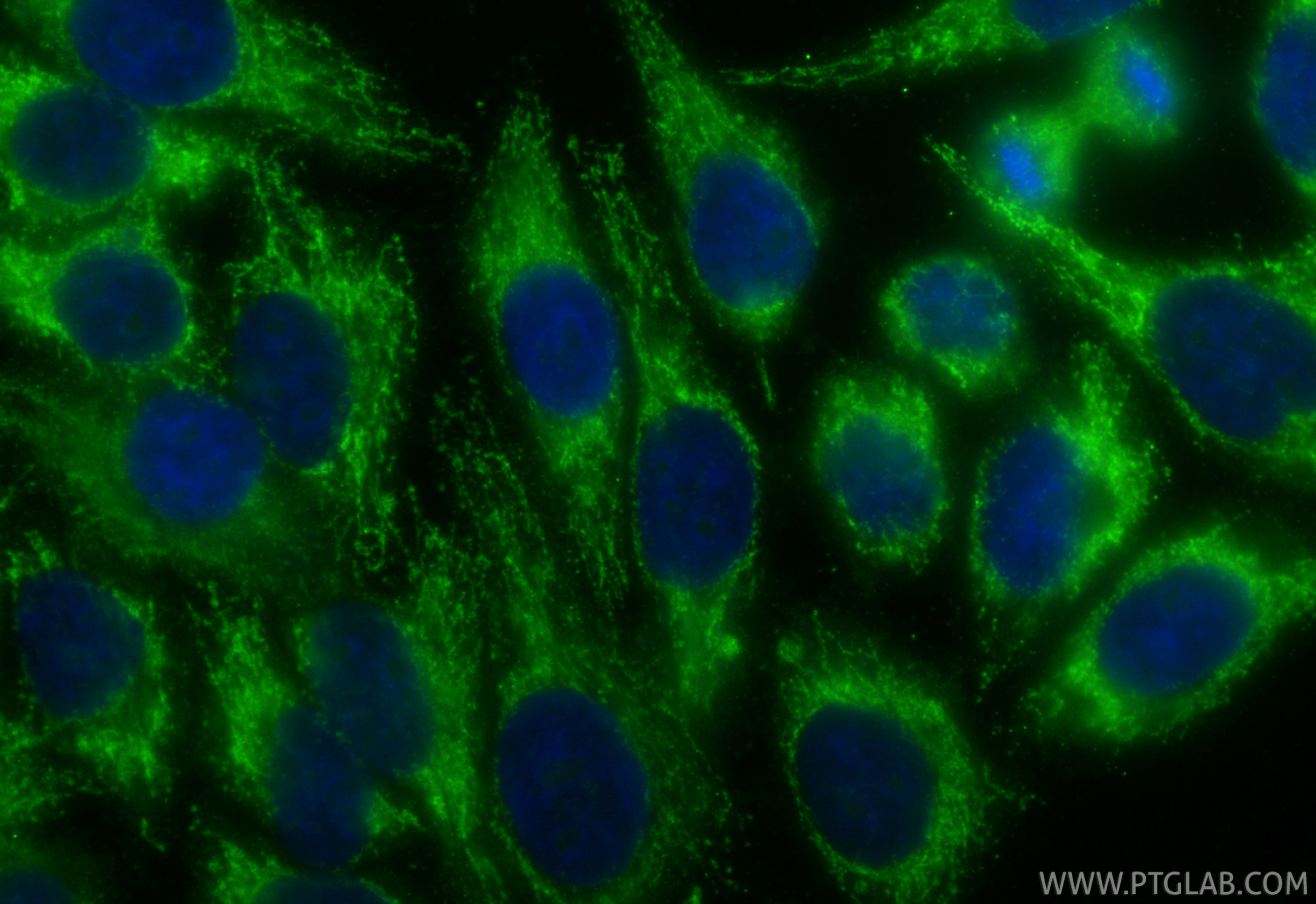 Immunofluorescence (IF) / fluorescent staining of HepG2 cells using CoraLite® Plus 488-conjugated Albumin Polyclonal a (CL488-16475)