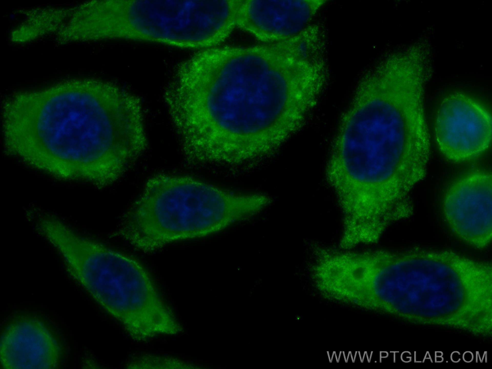Immunofluorescence (IF) / fluorescent staining of HepG2 cells using CoraLite® Plus 488-conjugated Albumin Monoclonal a (CL488-66051)