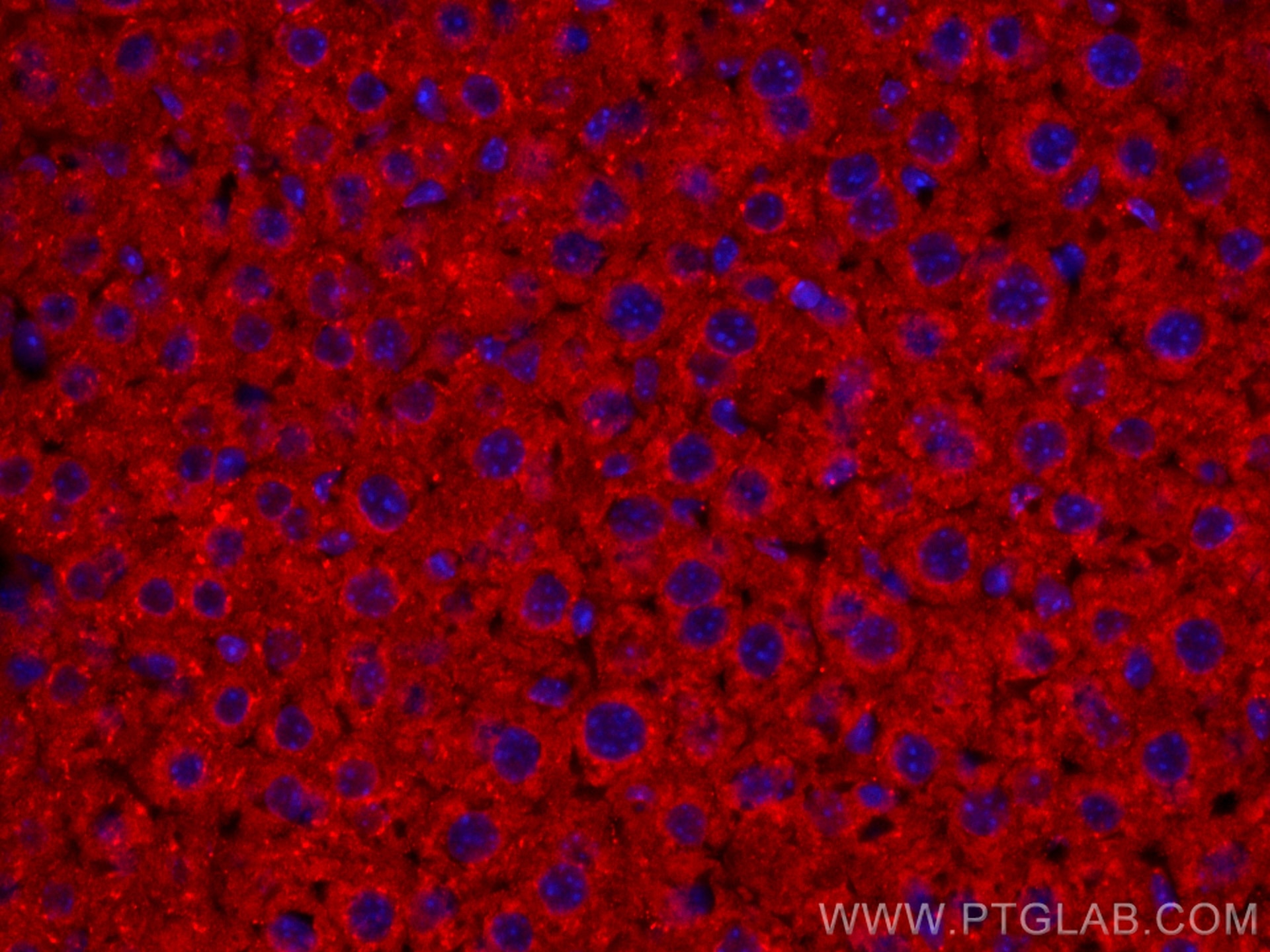 Immunofluorescence (IF) / fluorescent staining of mouse liver tissue using CoraLite®594-conjugated Albumin Polyclonal antibod (CL594-16475)