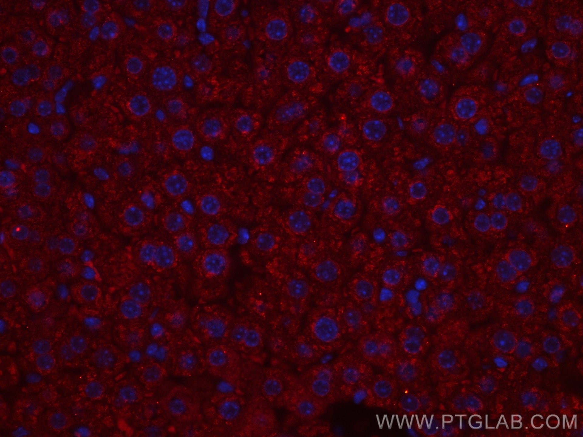 Immunofluorescence (IF) / fluorescent staining of mouse liver tissue using CoraLite®594-conjugated Albumin Monoclonal antibod (CL594-66051)