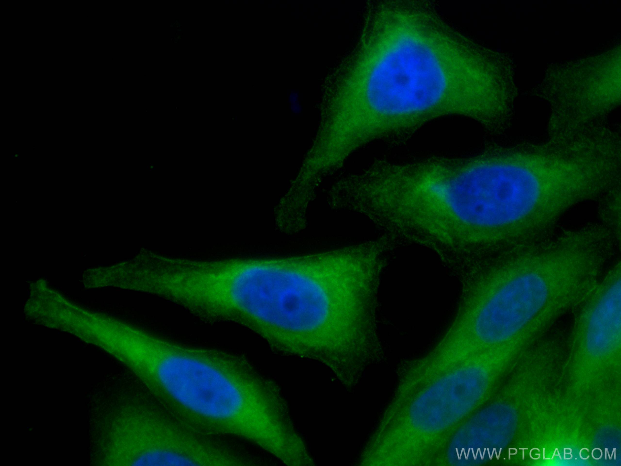 Immunofluorescence (IF) / fluorescent staining of HepG2 cells using CoraLite® Plus 488-conjugated Aldolase C Monoclona (CL488-66120)