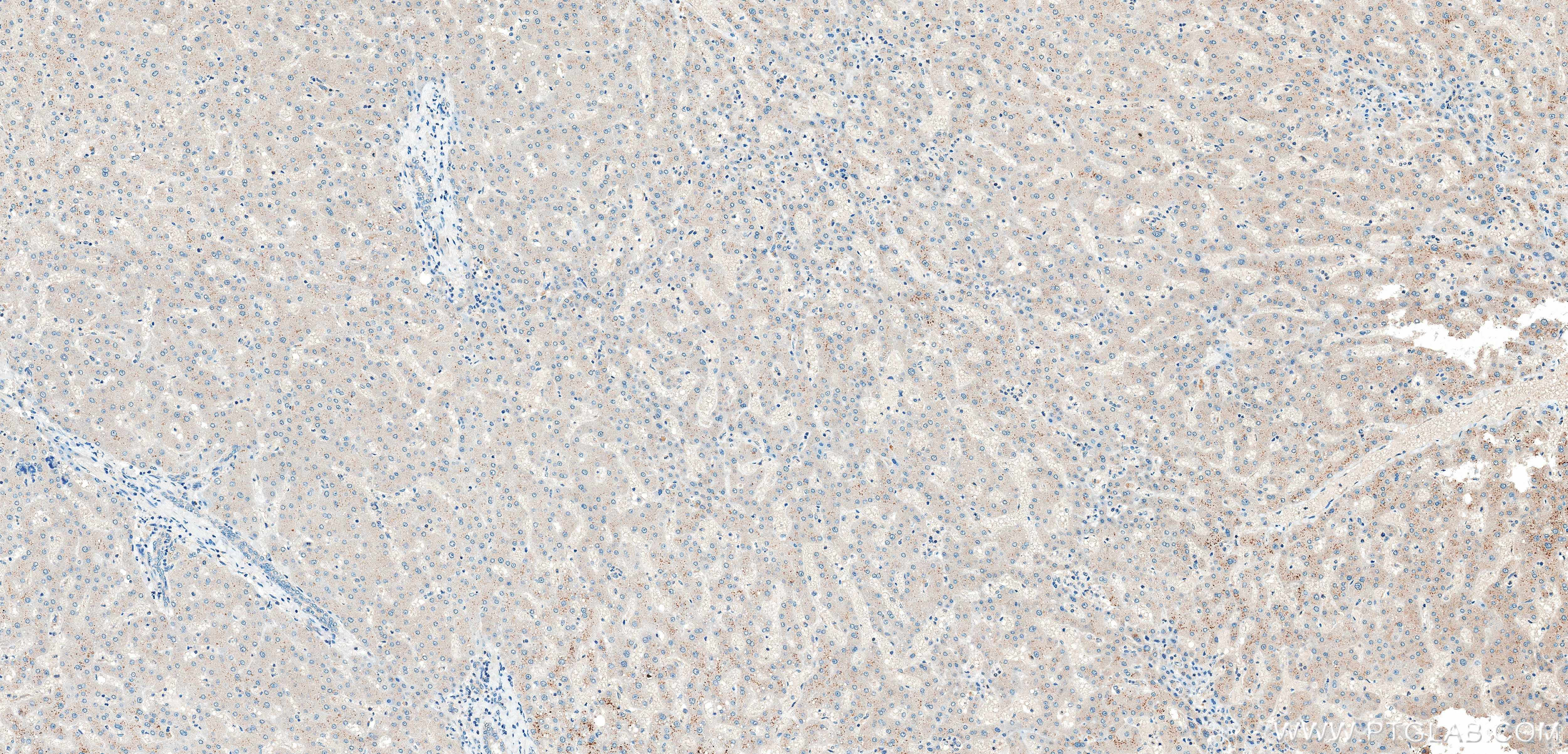 IHC staining of human liver using 86644-1-RR (same clone as 86644-1-PBS) Immunohistochemistry (IHC) staining of human liver tissue using Alix Recombinant monoclonal antibody (86644-1-RR)