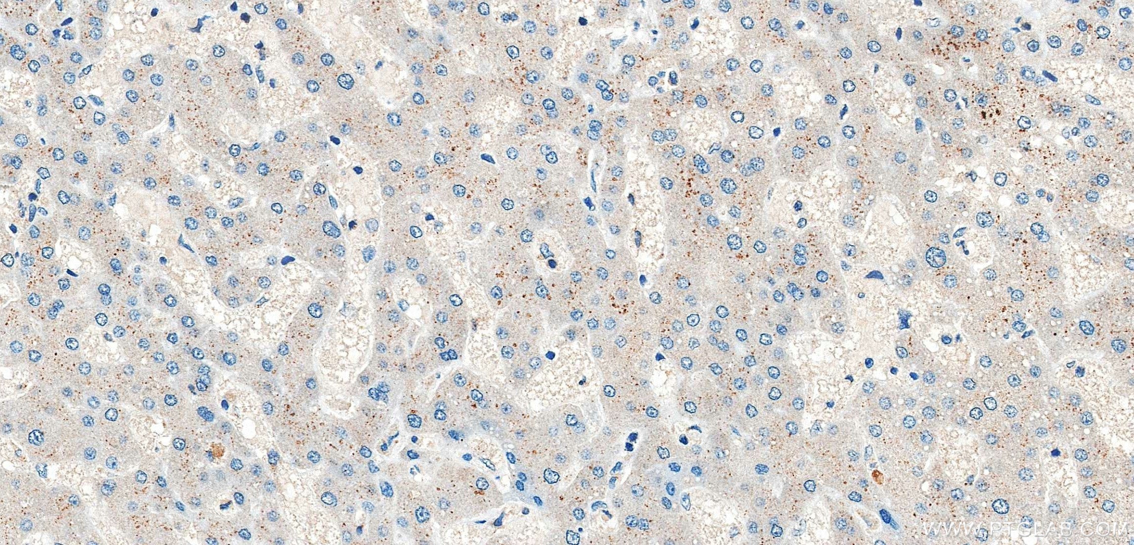 IHC staining of human liver using 86644-1-RR (same clone as 86644-1-PBS) Immunohistochemistry (IHC) staining of human liver tissue using Alix Recombinant monoclonal antibody (86644-1-RR)