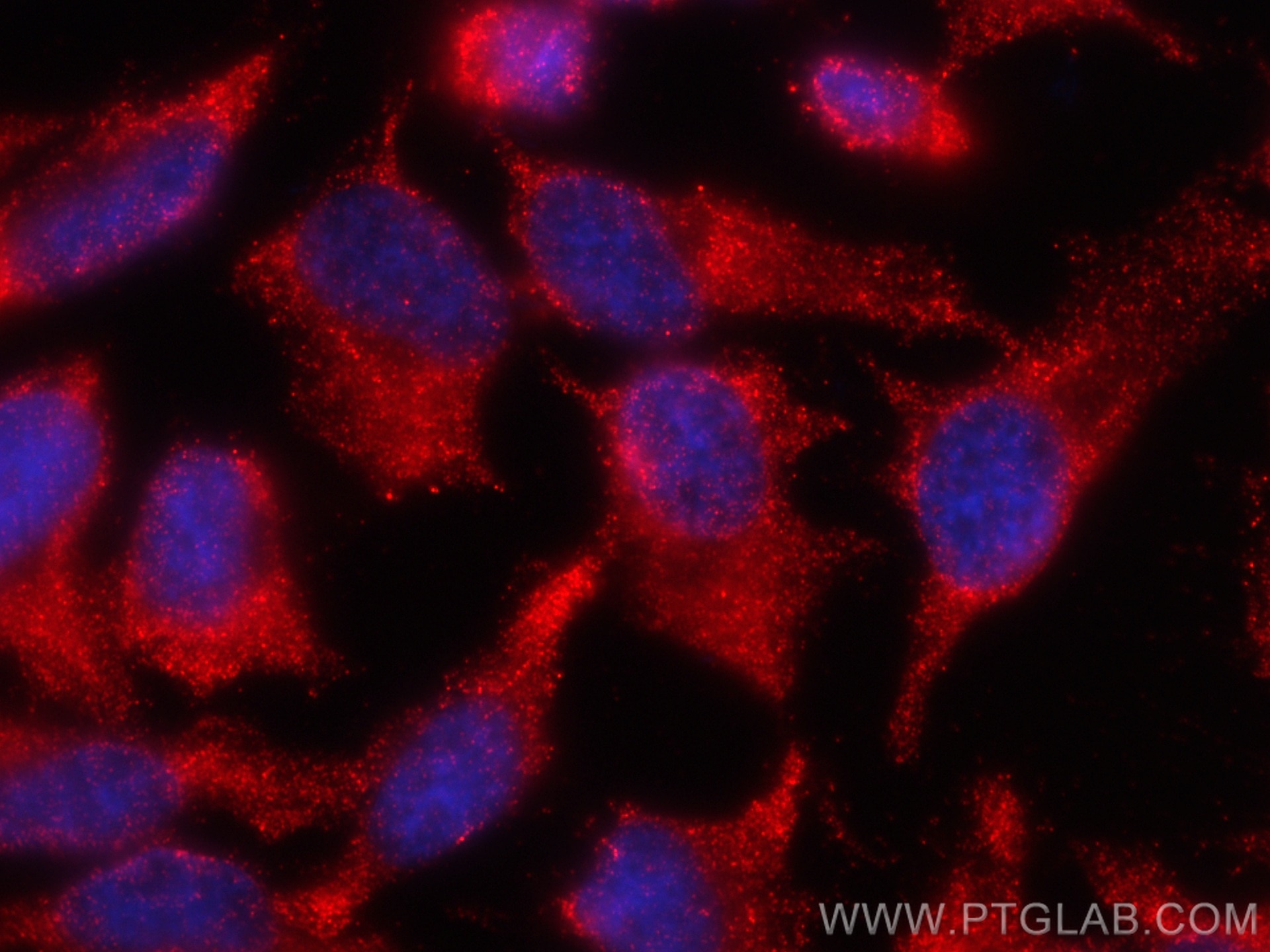 Immunofluorescence (IF) / fluorescent staining of HeLa cells using CoraLite®594-conjugated Alix Monoclonal antibody (CL594-67715)