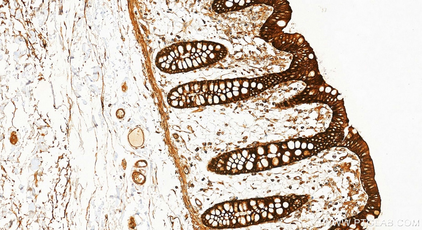 Immunohistochemistry (IHC) staining of human colon tissue using Multi-rAb® Alix Multi-Recombinant antibody (RMX00081)