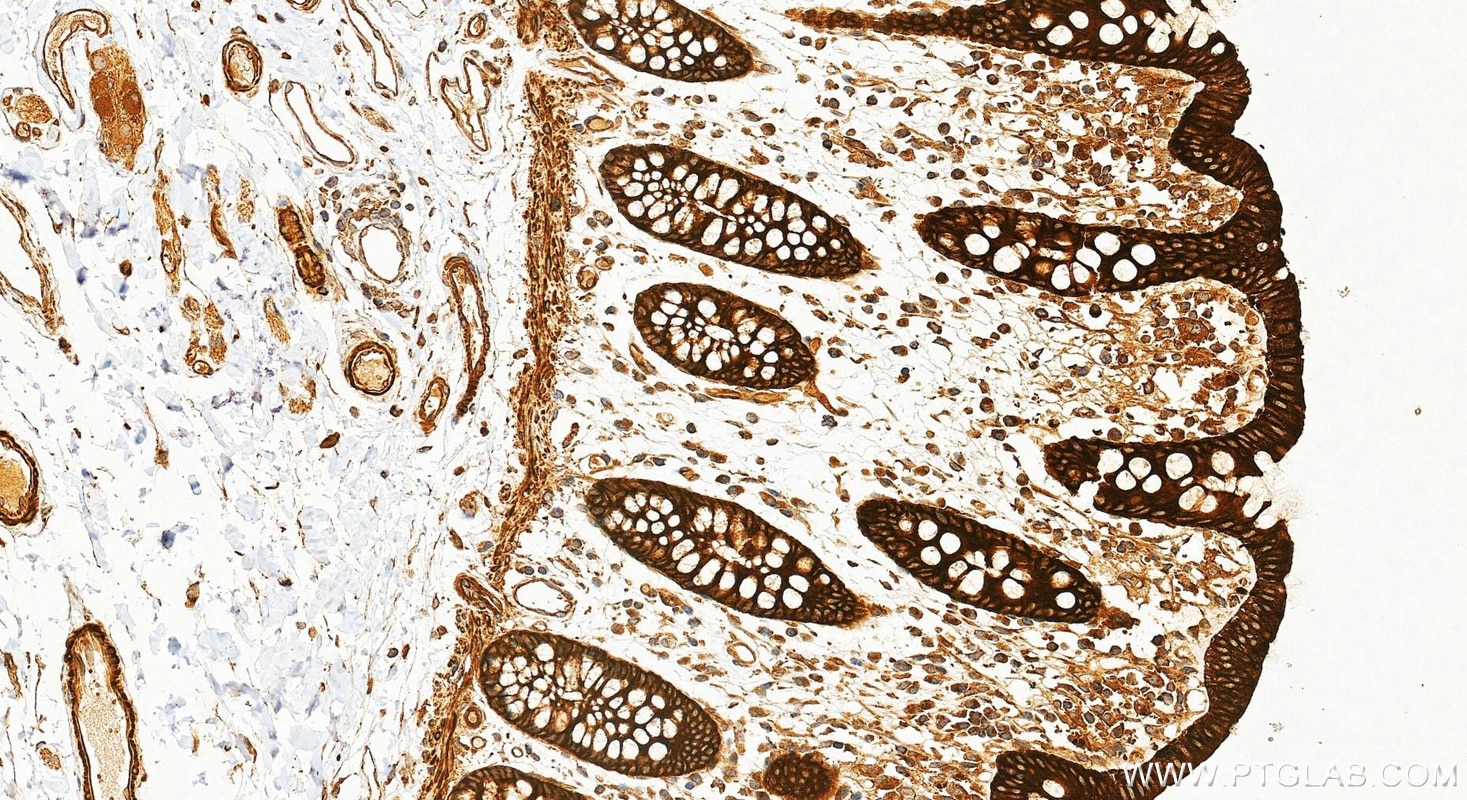Immunohistochemistry (IHC) staining of human colon tissue using Multi-rAb® Alix Multi-Recombinant antibody (RMX00081)