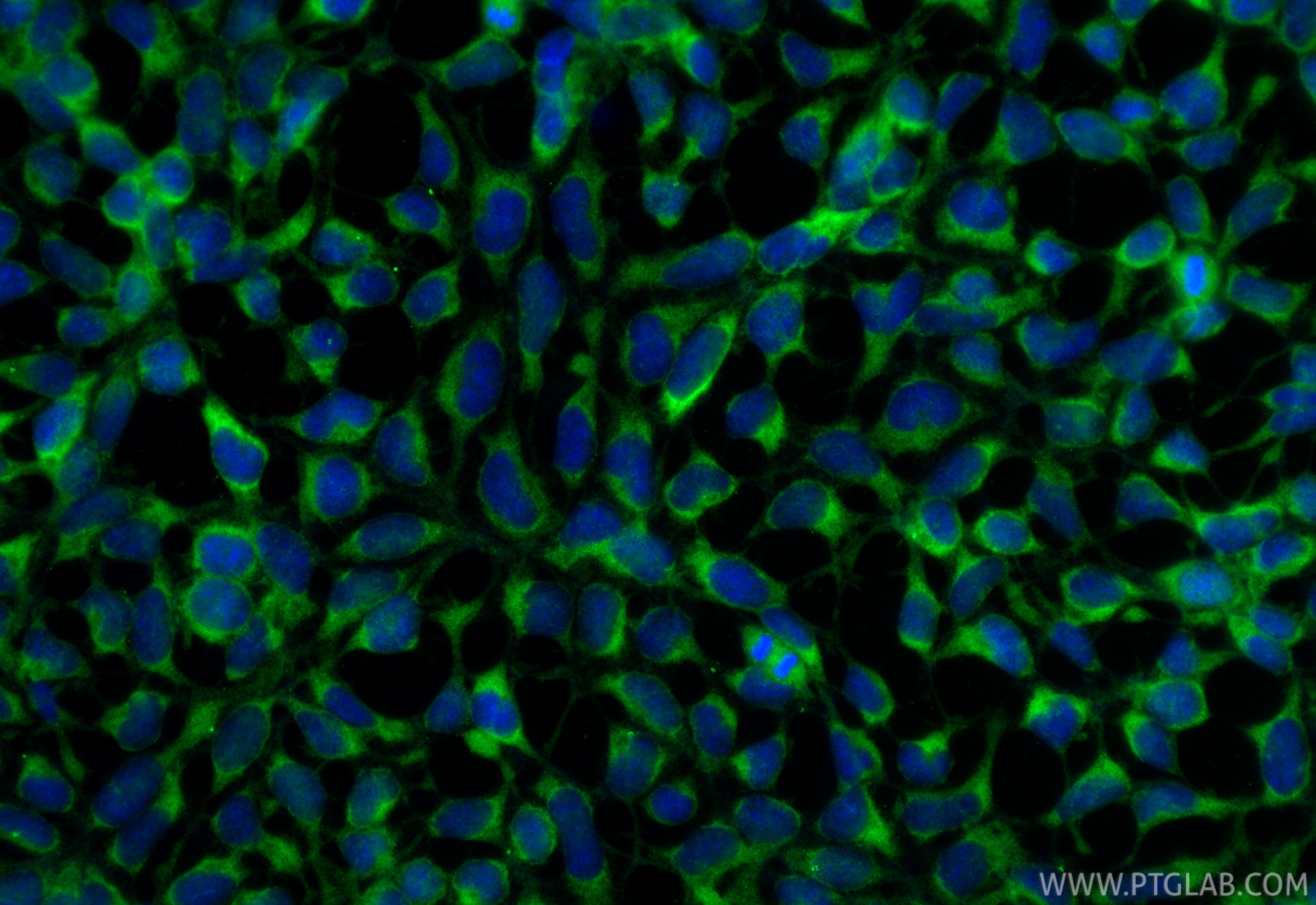 Immunofluorescence (IF) / fluorescent staining of HEK-293 cells using Multi-rAb® Alix Multi-Recombinant antibody (RMX00081)