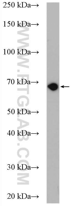 Alkyl-DHAP synthase/AGPS