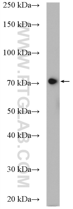 Western Blot (WB) analysis of HeLa cells using Alkyl-DHAP synthase/AGPS Polyclonal antibody (21011-1-AP)