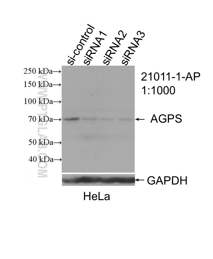 Western Blot (WB) analysis of HeLa cells using Alkyl-DHAP synthase/AGPS Polyclonal antibody (21011-1-AP)