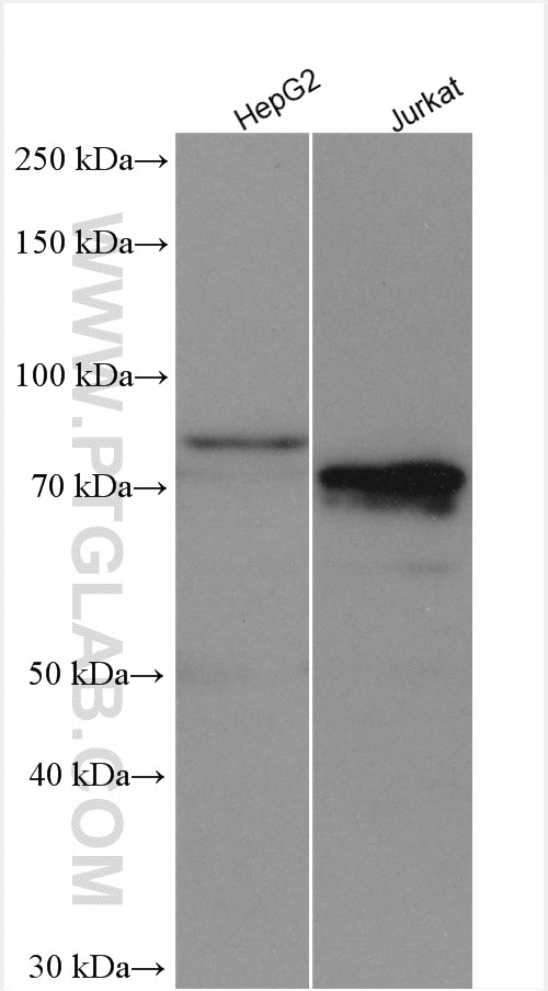 Western Blot (WB) analysis of various lysates using Alkyl-DHAP synthase/AGPS Polyclonal antibody (21011-1-AP)