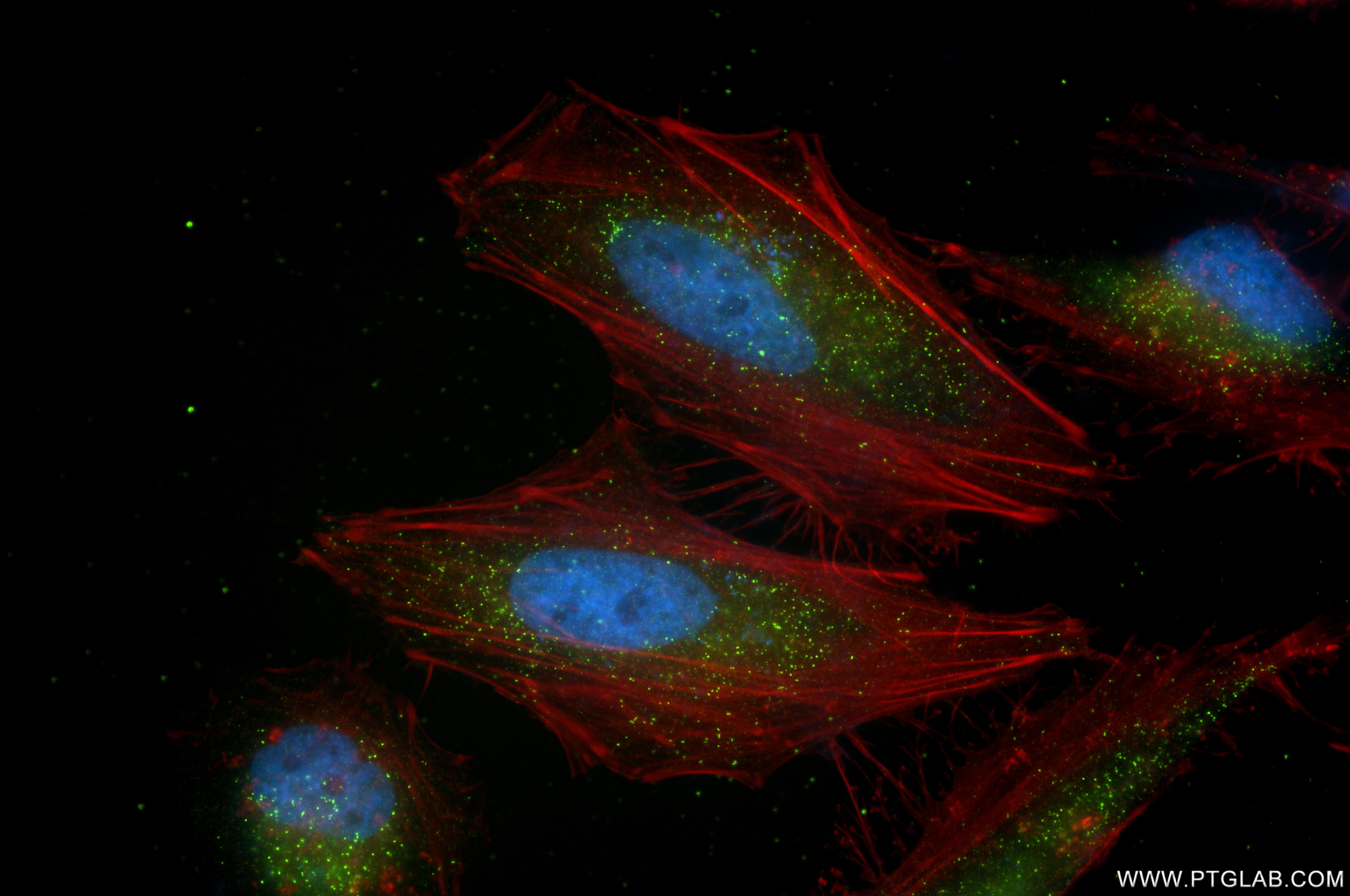 Immunofluorescence (IF) / fluorescent staining of HeLa cells using Alkyl-DHAP synthase/AGPS Recombinant antibody (86472-3-RR)