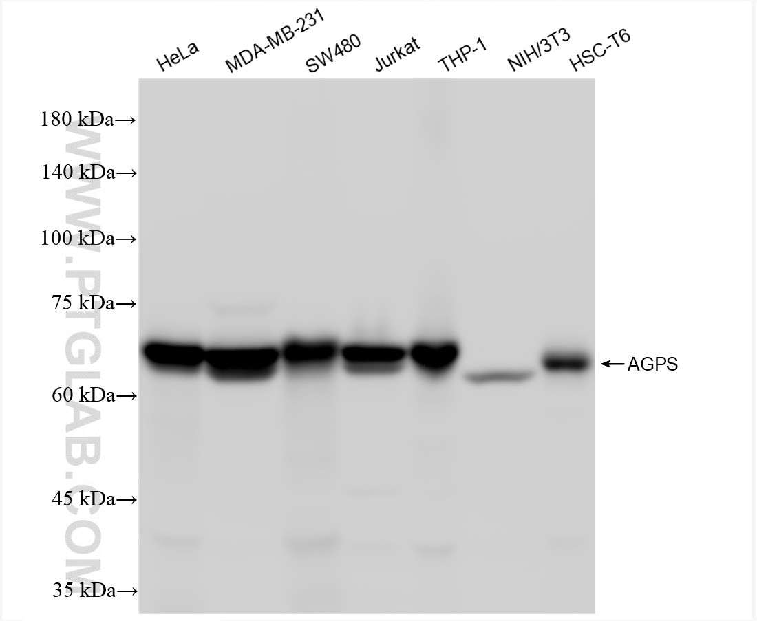 Western Blot (WB) analysis of various lysates using Alkyl-DHAP synthase/AGPS Recombinant antibody (86472-3-RR)