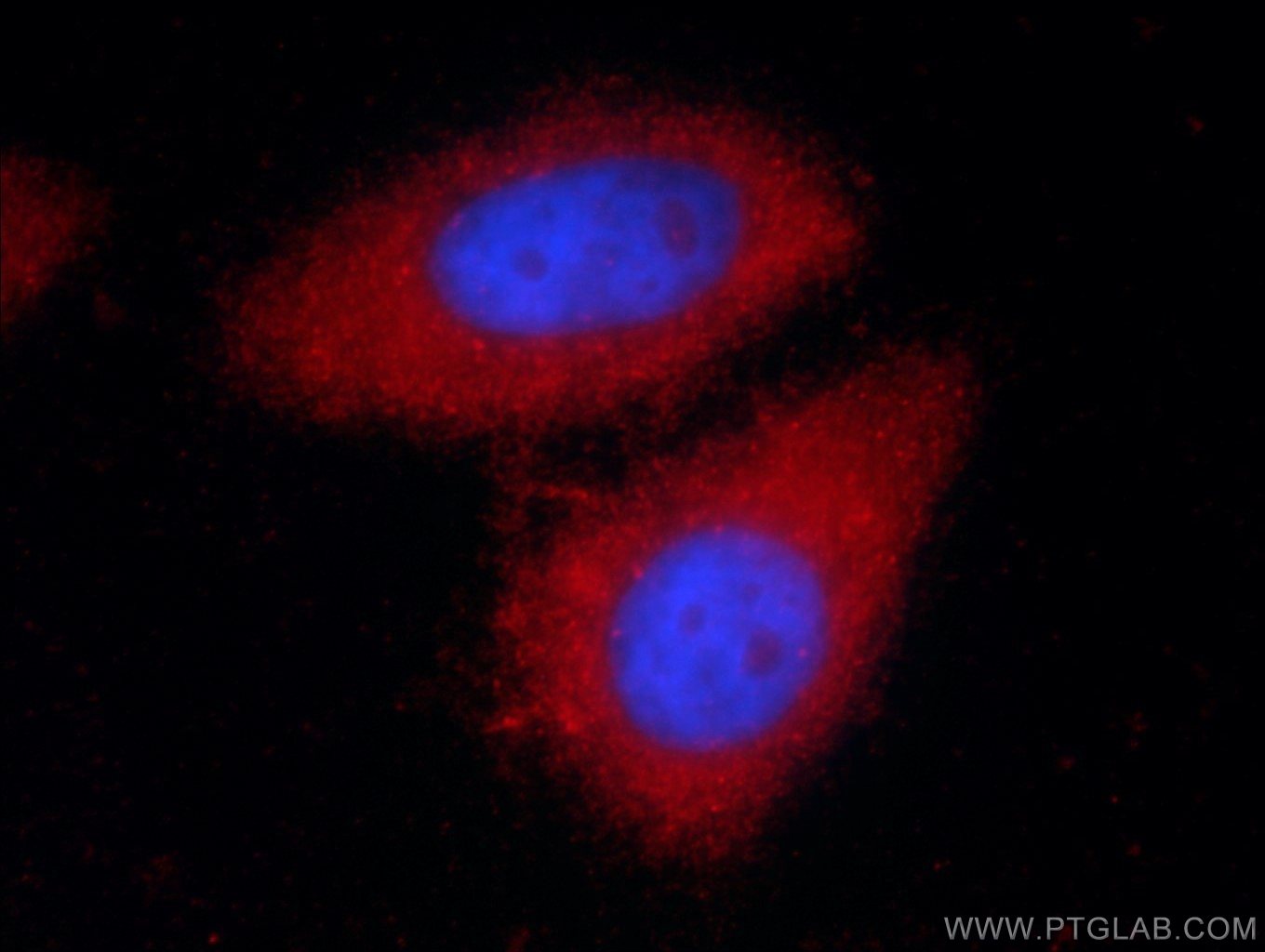 Alpha 1 Antitrypsin