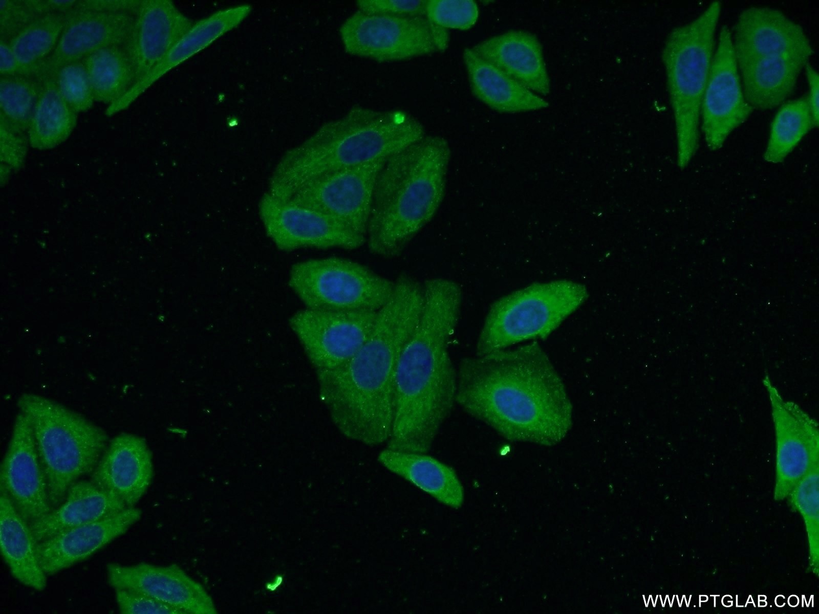 Immunofluorescence (IF) / fluorescent staining of HepG2 cells using Alpha 1 Antitrypsin Monoclonal antibody (66135-1-Ig)