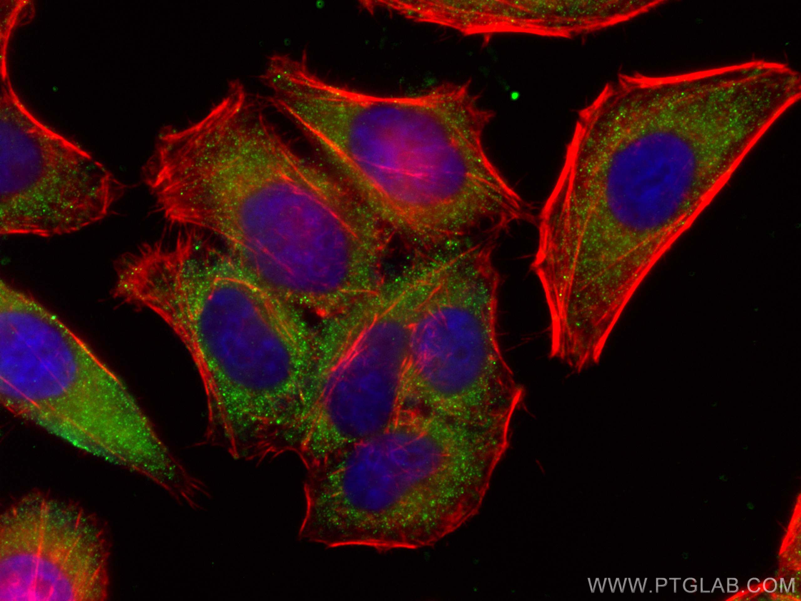 Immunofluorescence (IF) / fluorescent staining of HepG2 cells using Alpha 1 Antitrypsin Monoclonal antibody (66135-1-Ig)